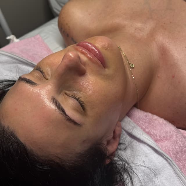 Skin Reset Package at EmVie Aesthetics in Hammond, LA