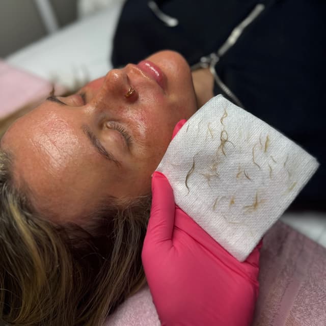 Go & Glow Membership at EmVie Aesthetics in Hammond, LA