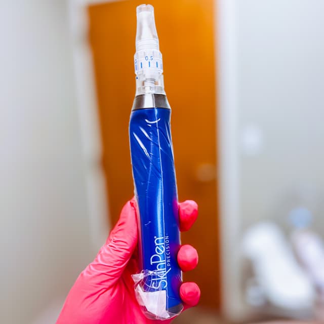 SkinPen Microneedling Package at EmVie Aesthetics in Hammond, LA